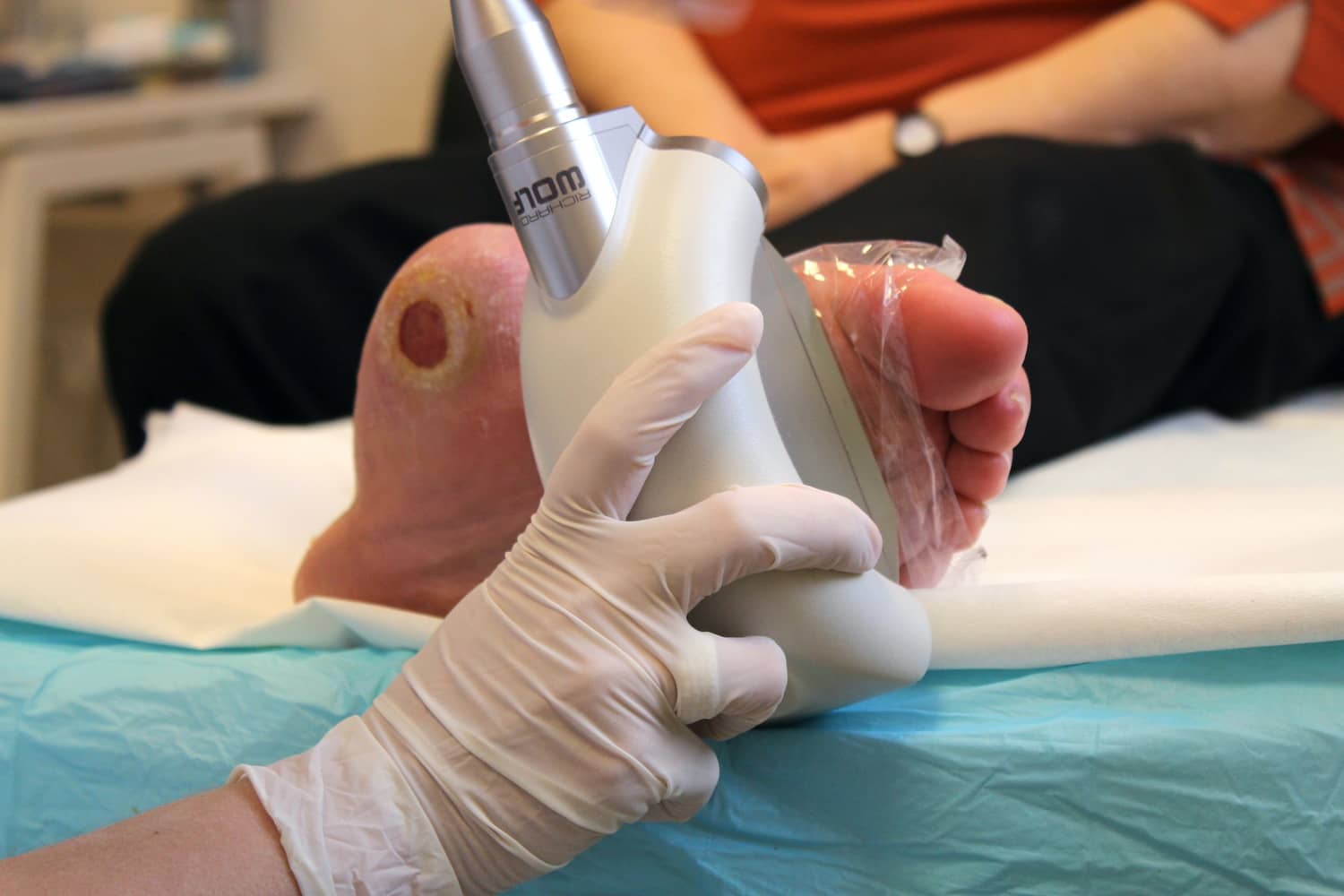 Lágylézer terápia a cukorbeteg láb sebeinek kezelésében - Istenhegyi Magánklinika