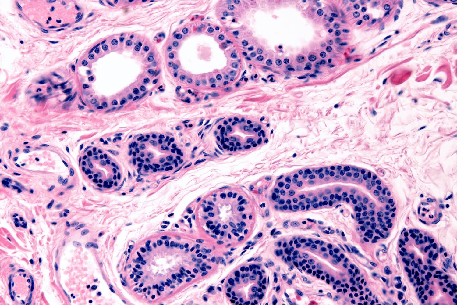 Apokrin (fent) és ekrin (lent) mirigyek emberi bőrszövet mikroszkópos keresztmetszeti képén