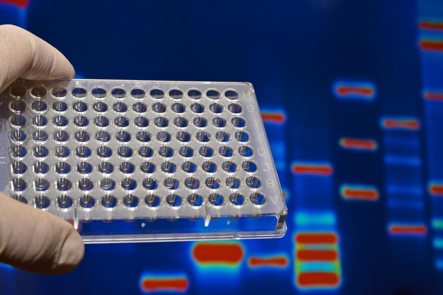 A pajzsmirigy molekeuláris diagnosztikája